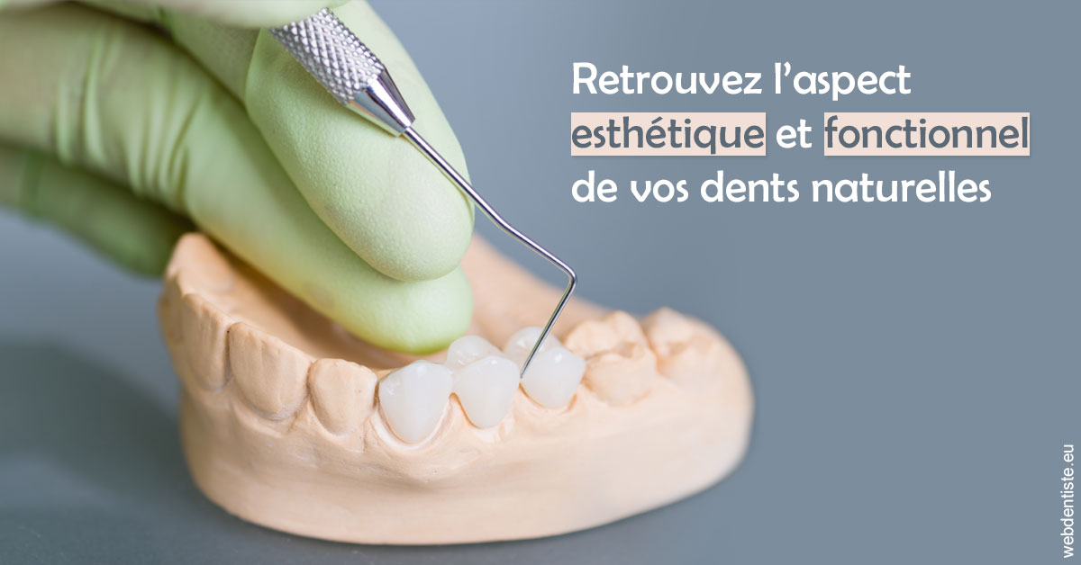 https://dr-nicolas-baert.chirurgiens-dentistes.fr/Restaurations dentaires 1