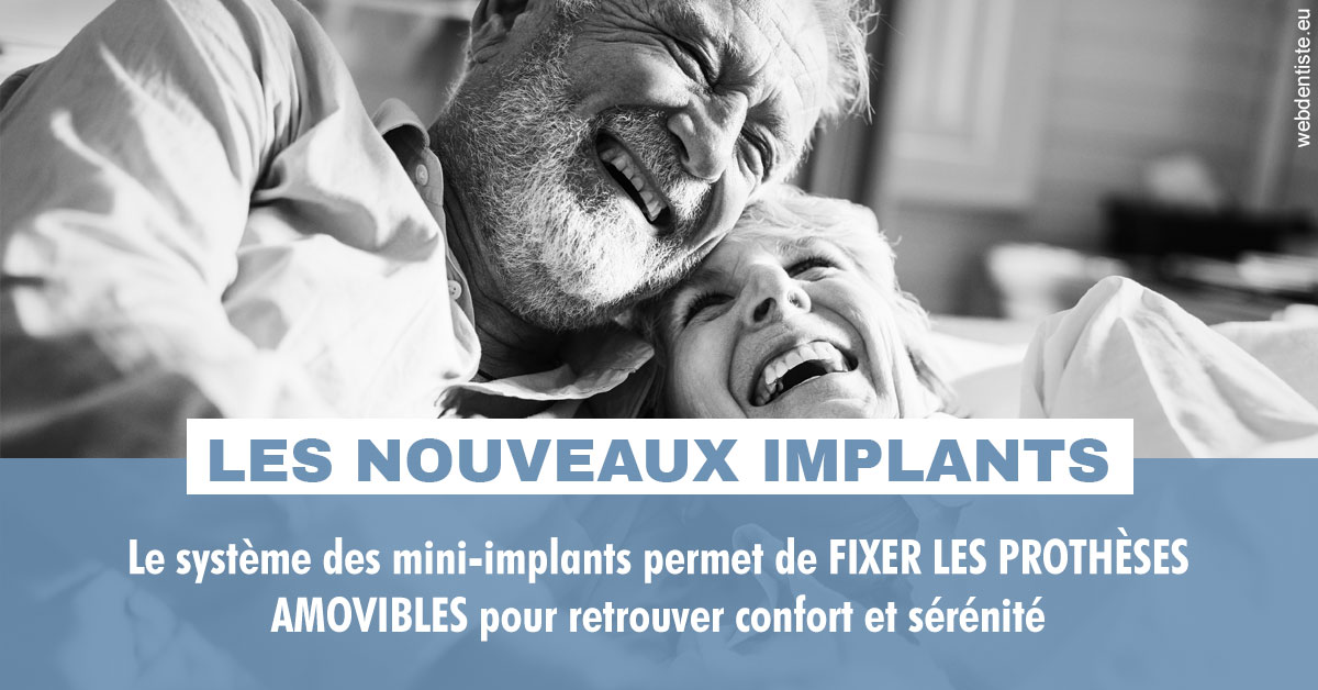 https://dr-nicolas-baert.chirurgiens-dentistes.fr/Les nouveaux implants 2