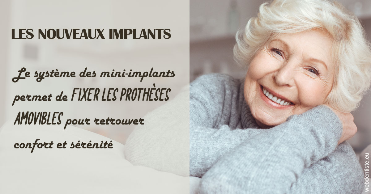 https://dr-nicolas-baert.chirurgiens-dentistes.fr/Les nouveaux implants 1