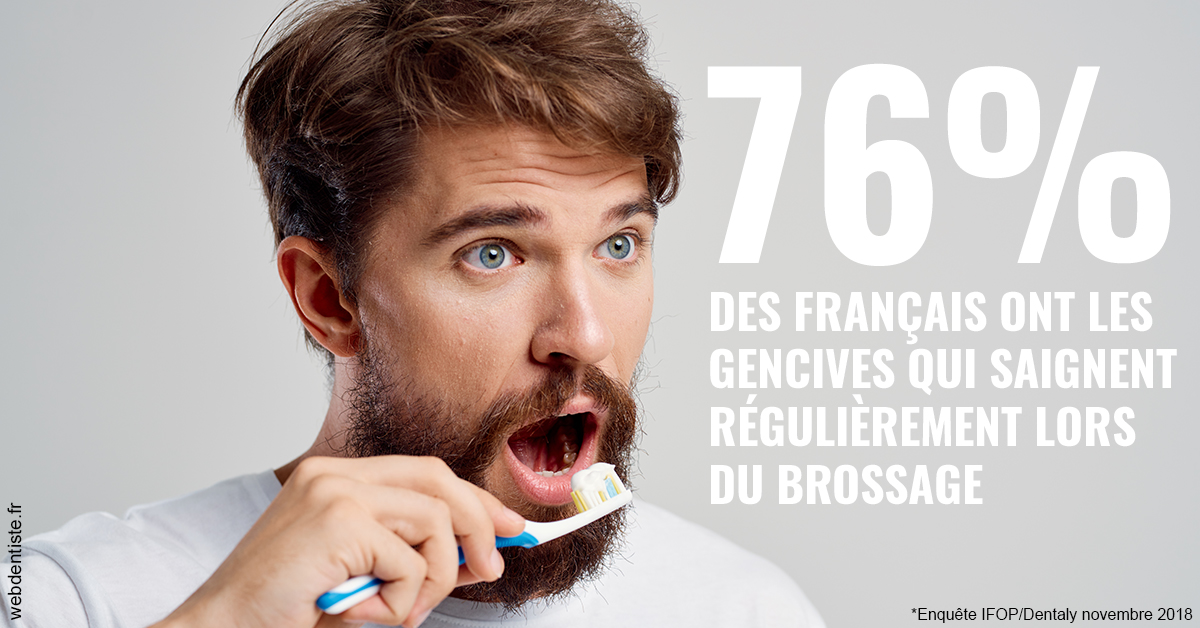 https://dr-nicolas-baert.chirurgiens-dentistes.fr/76% des Français 2