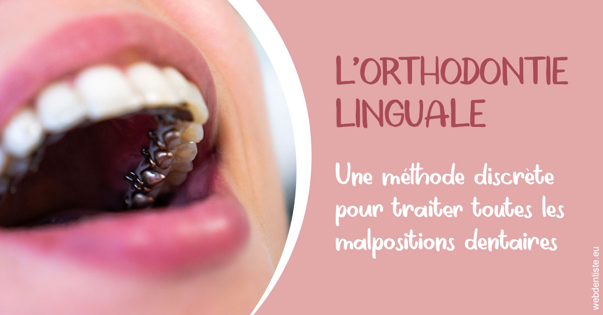 https://dr-nicolas-baert.chirurgiens-dentistes.fr/L'orthodontie linguale 2
