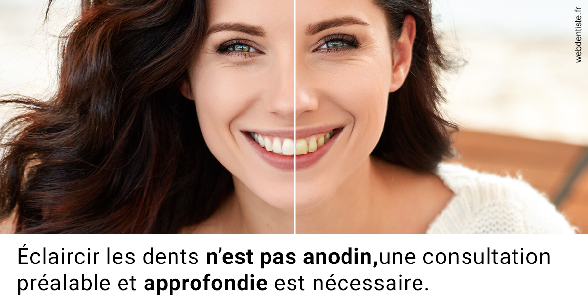 https://dr-nicolas-baert.chirurgiens-dentistes.fr/Le blanchiment 2