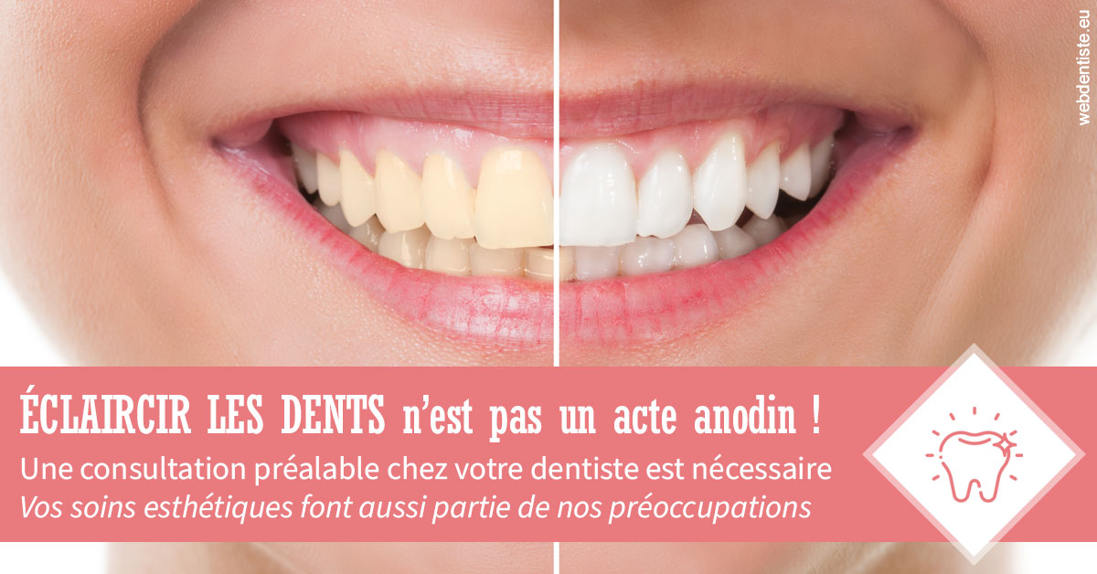 https://dr-nicolas-baert.chirurgiens-dentistes.fr/Eclaircir les dents 1