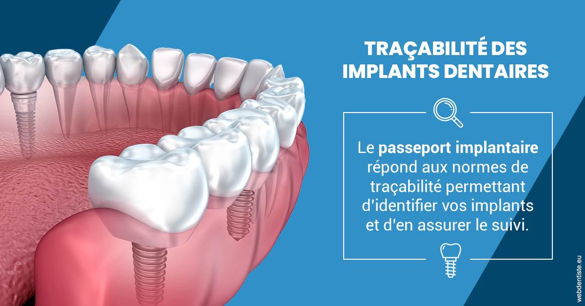 https://dr-nicolas-baert.chirurgiens-dentistes.fr/T2 2023 - Traçabilité des implants 1