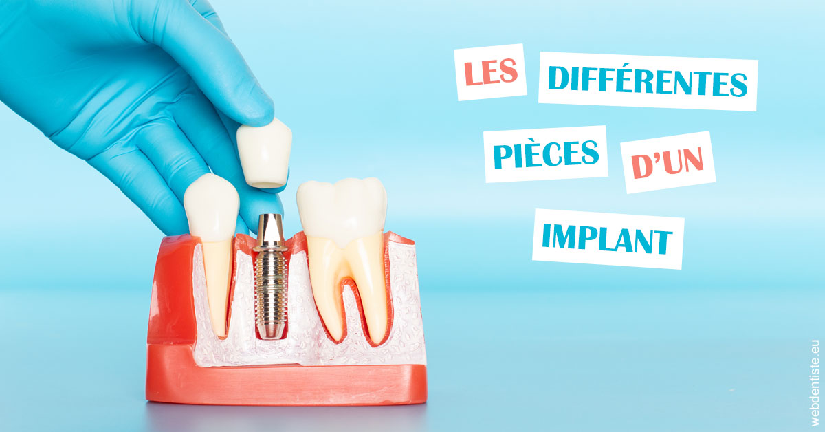 https://dr-nicolas-baert.chirurgiens-dentistes.fr/Les différentes pièces d’un implant 2