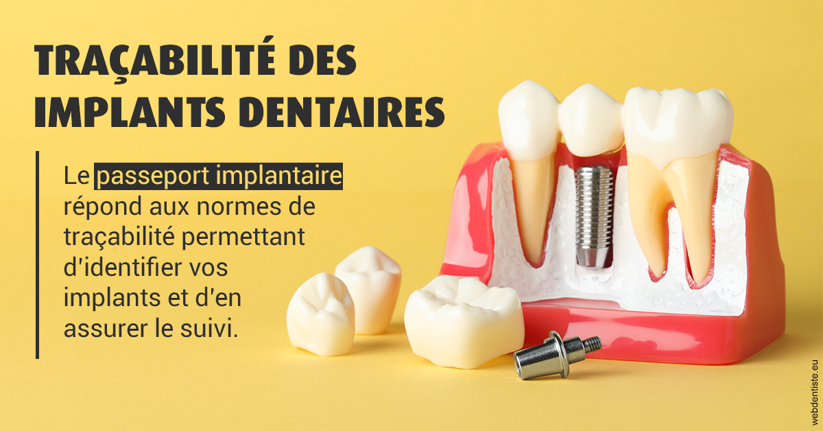 https://dr-nicolas-baert.chirurgiens-dentistes.fr/T2 2023 - Traçabilité des implants 2