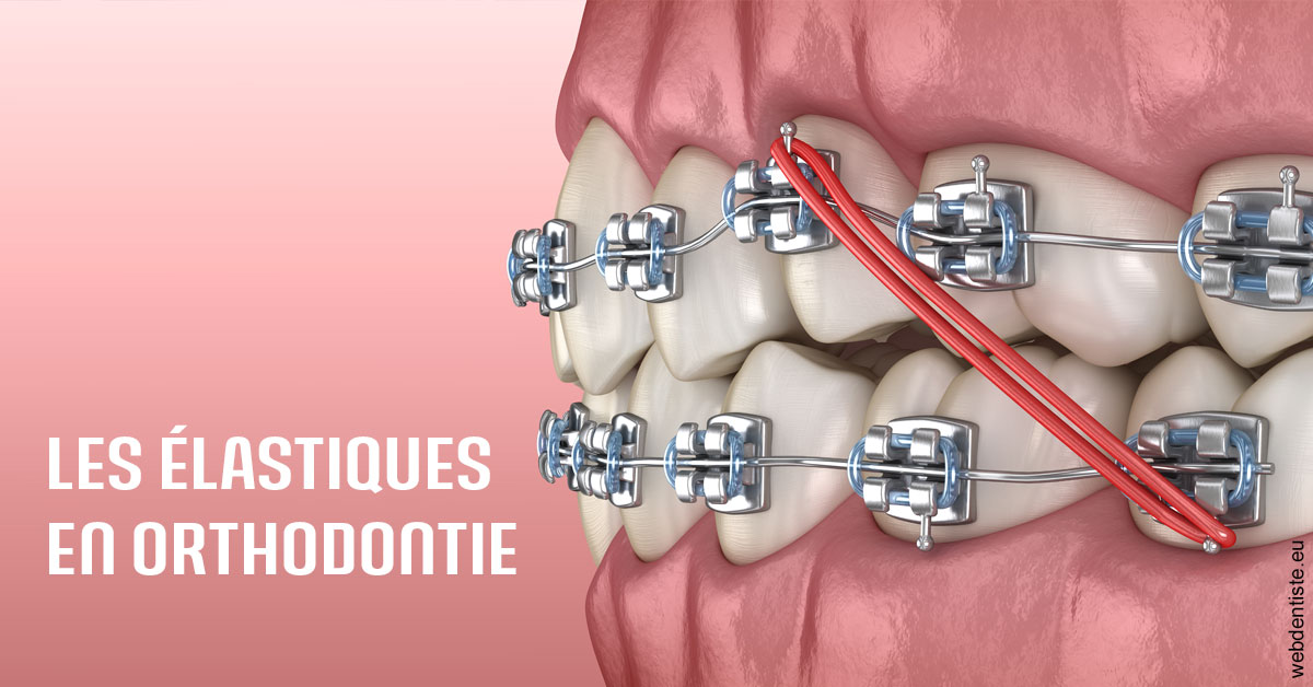 https://dr-nicolas-baert.chirurgiens-dentistes.fr/Elastiques orthodontie 2