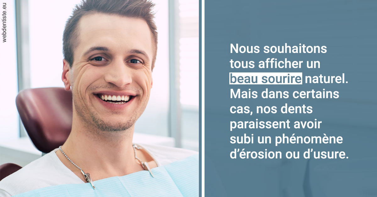 https://dr-nicolas-baert.chirurgiens-dentistes.fr/Érosion et usure dentaire