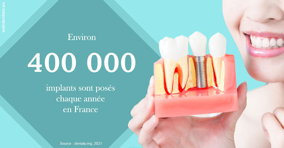 https://dr-nicolas-baert.chirurgiens-dentistes.fr/Pose d'implants en France 2