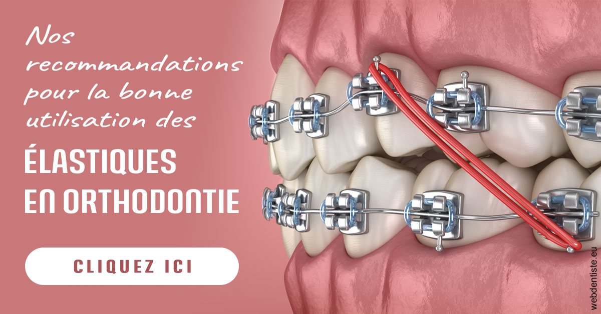 https://dr-nicolas-baert.chirurgiens-dentistes.fr/Elastiques orthodontie 2